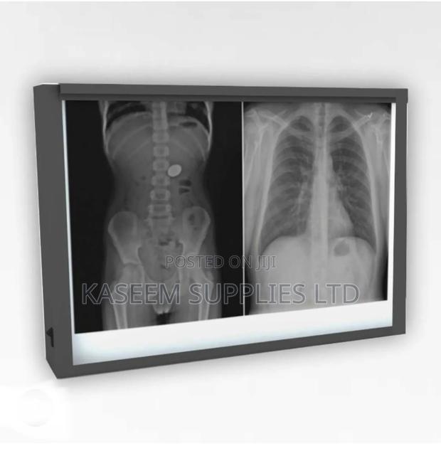 X-Ray Viewer Double - main view