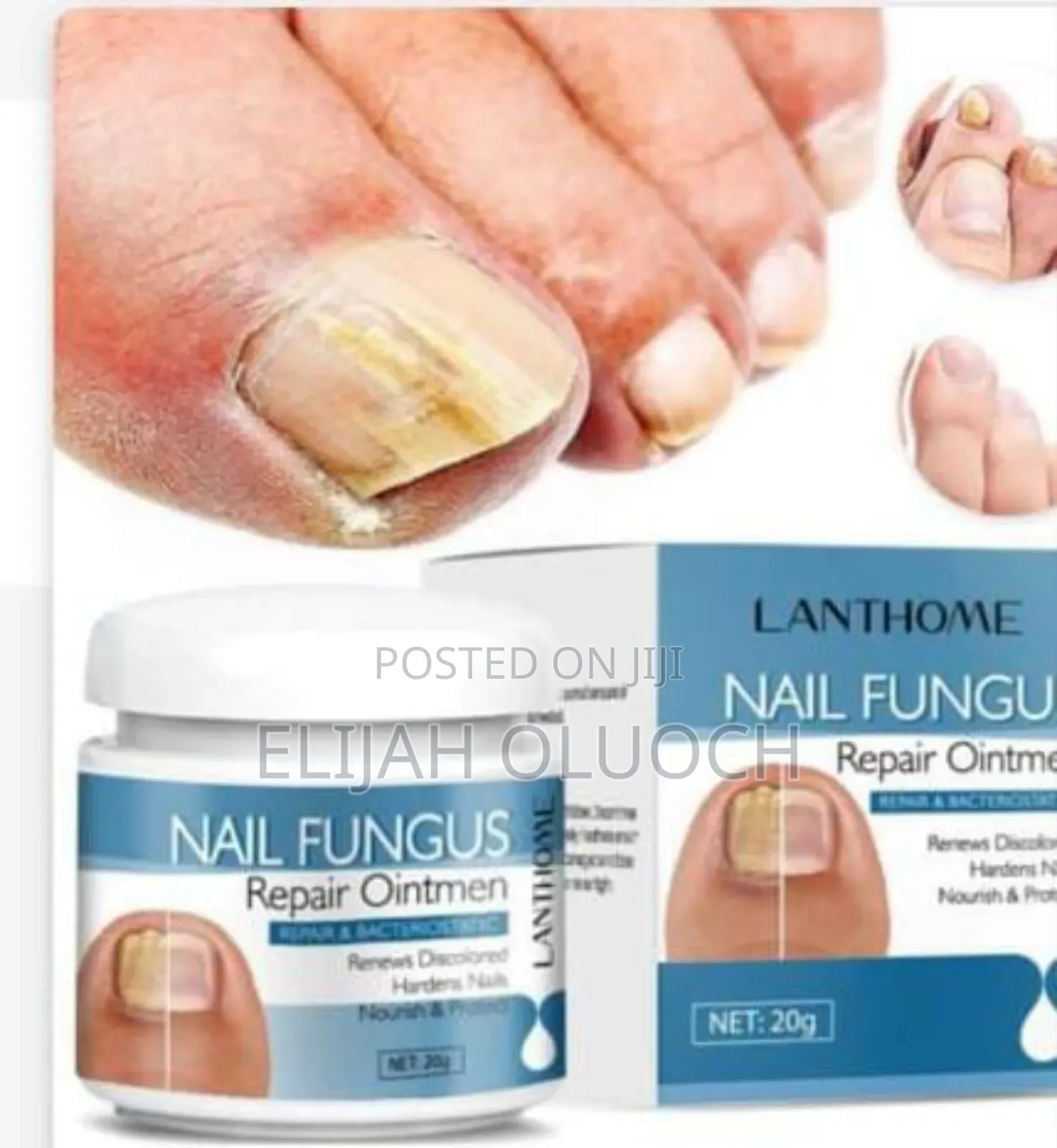 Nail Fungus Repair Ointment