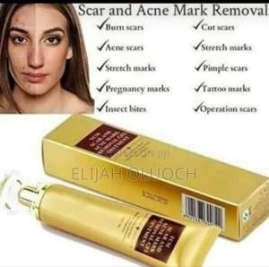 Scar and Acne Mark Removal - main view