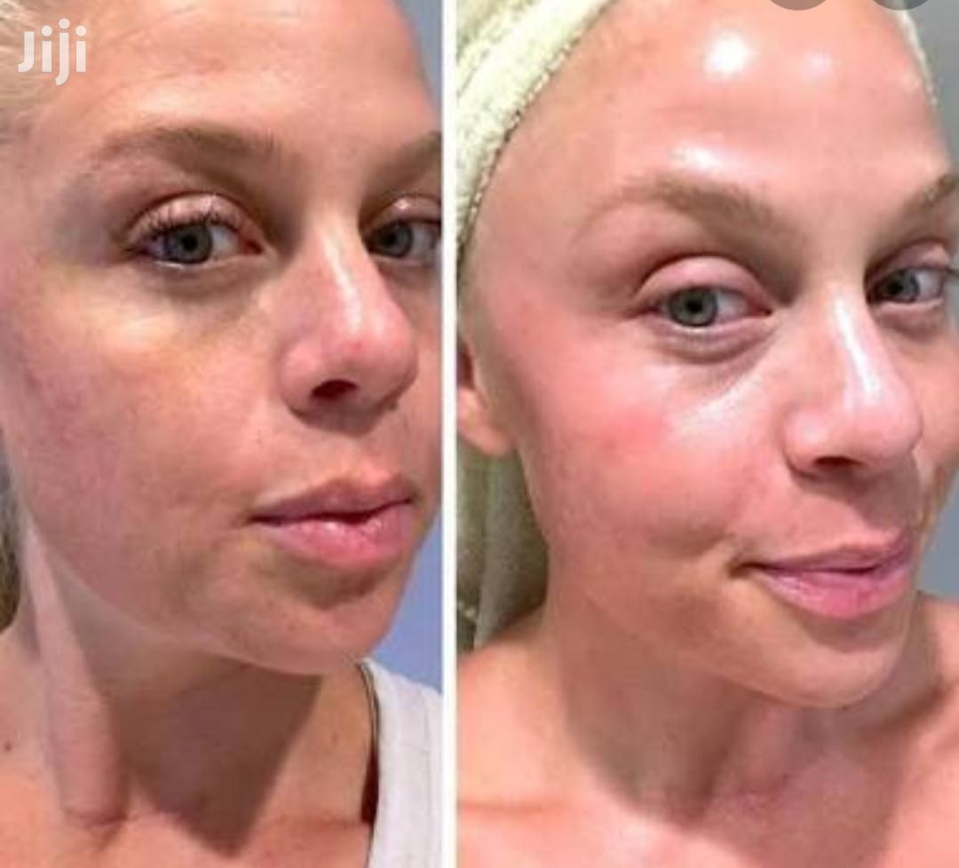 Sunburn and Melasma Eliminating Polla Cream.