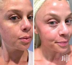 Sunburn and Melasma Eliminating Polla Cream.