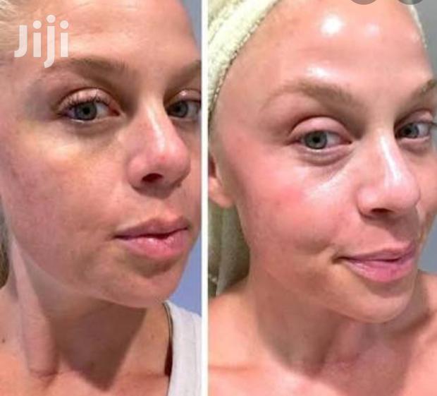 Sunburn and Melasma Eliminating Polla Cream. - thumbnail 3