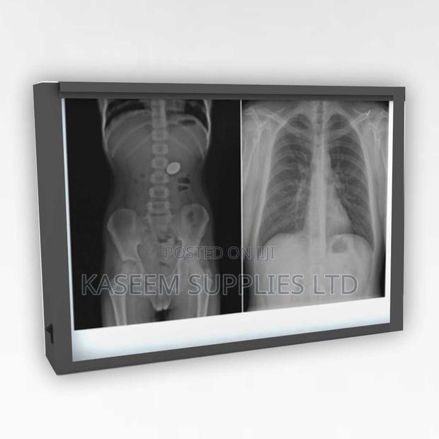 X-Ray Film Viewer (Double) - main view