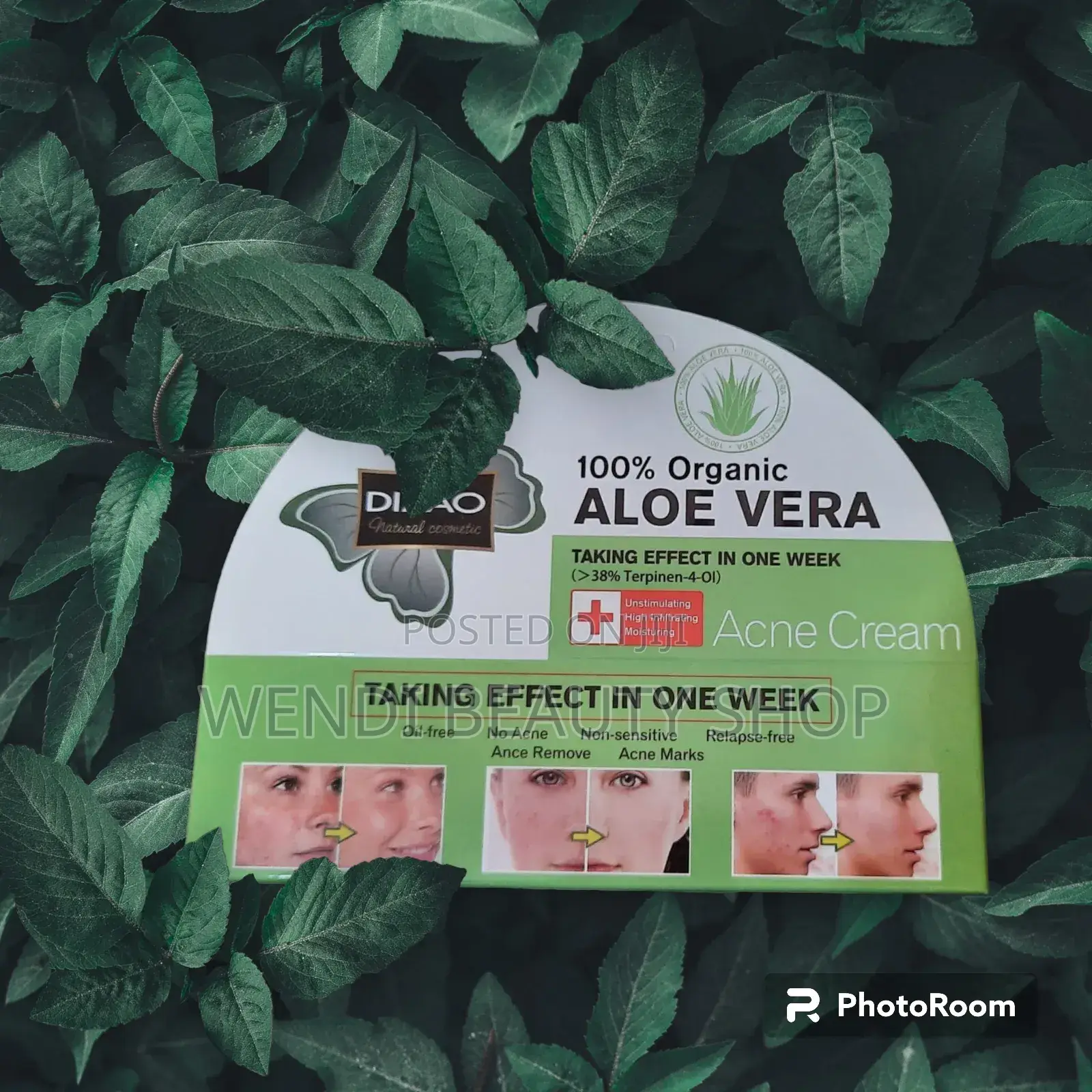 Aloe Vera Acne Removal Cream