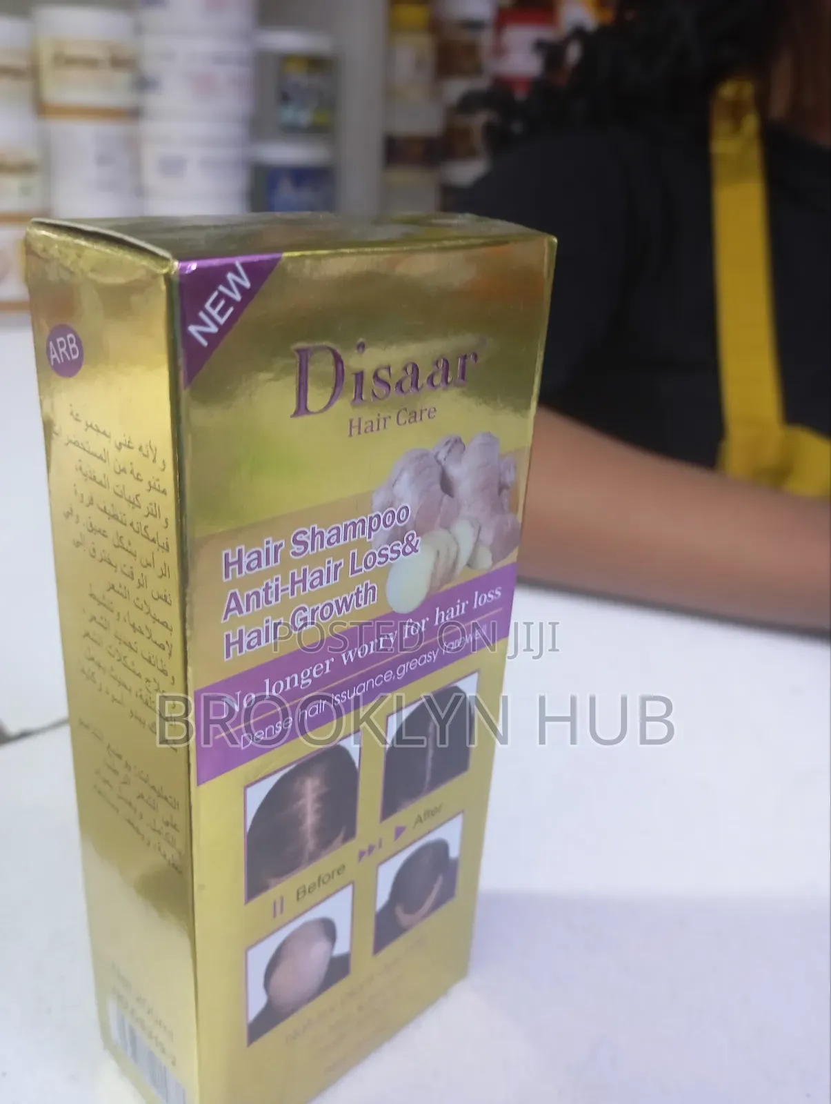 Natural Hair Loss Treatment * Hair Growth Essential