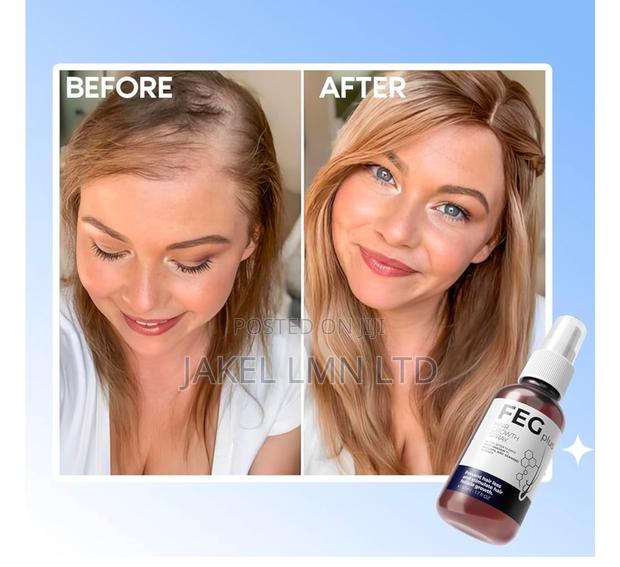 Feg Plus Hair Growth Spray - 50 Ml - thumbnail 4