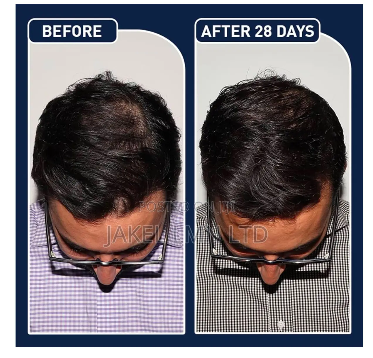 Feg Plus Hair Growth Spray - 50 Ml