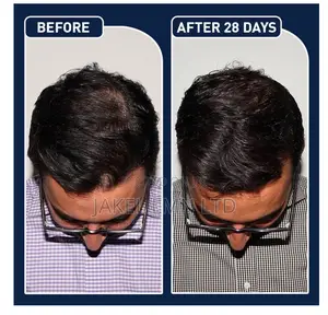 Feg Plus Hair Growth Spray - 50 Ml