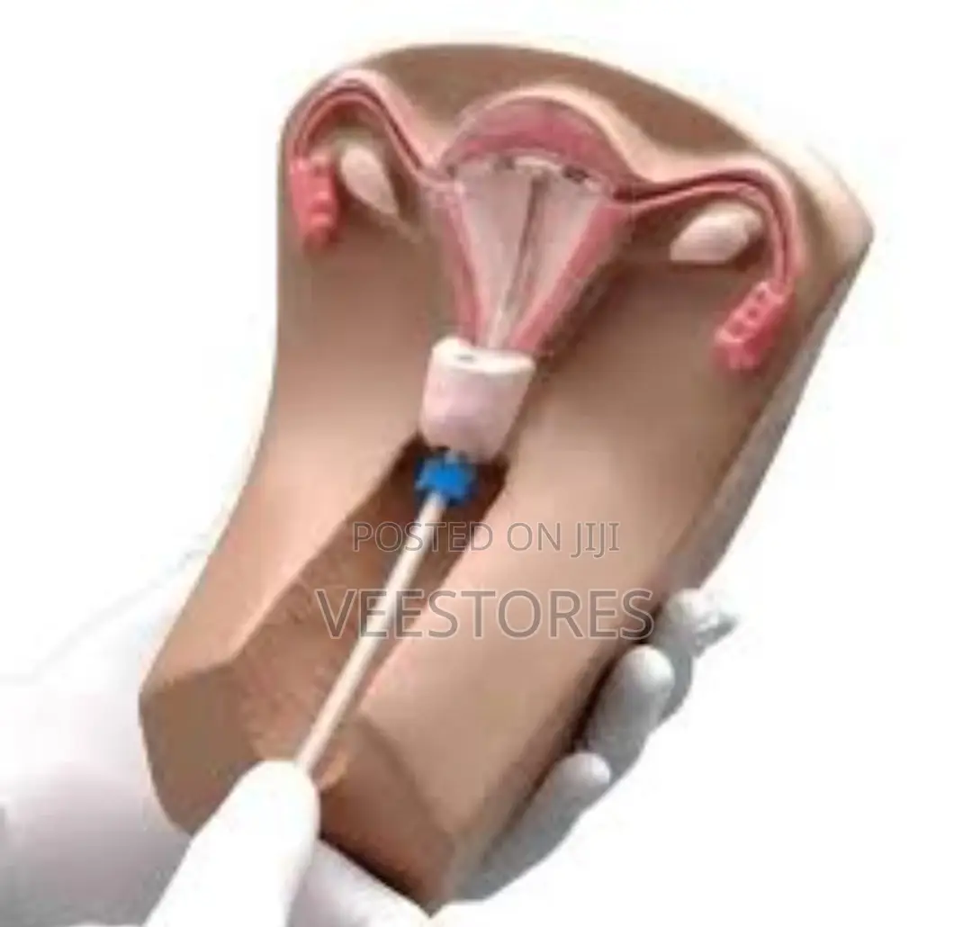 IUD Training Model