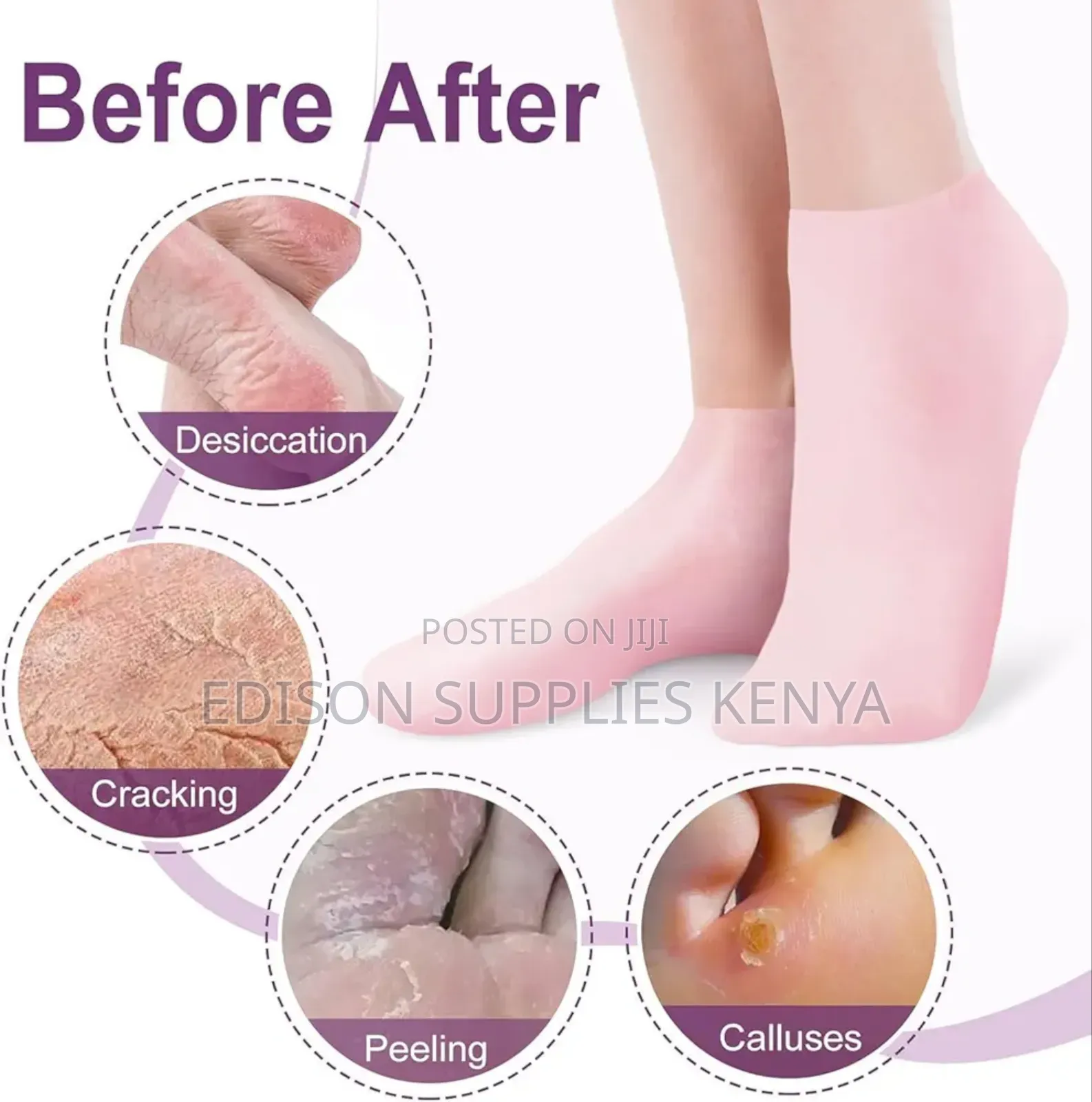 Silicone Socks for Women, Soft Gel Moisturizing Foot Socks