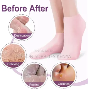 Silicone Socks for Women, Soft Gel Moisturizing Foot Socks