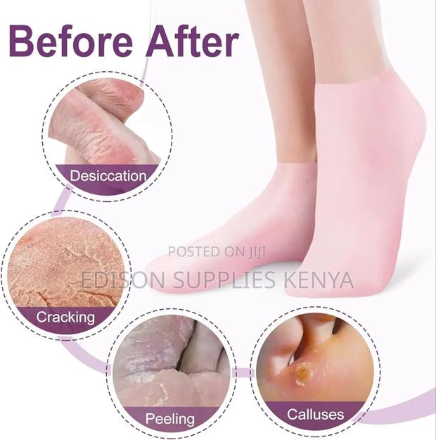Silicone Socks for Women, Soft Gel Moisturizing Foot Socks - thumbnail 4
