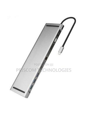 Vention Multi-Function 10-in-1 USB-C Docking Station - thumbnail 2