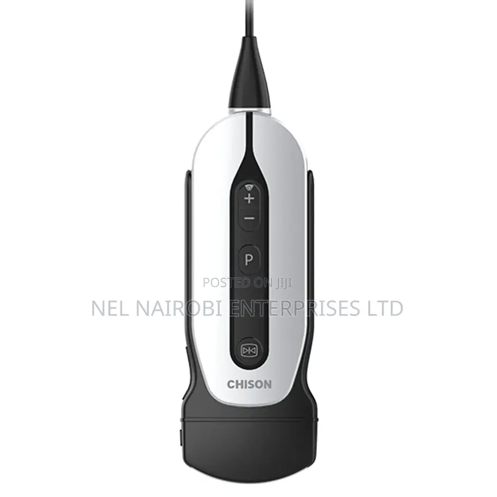 Convex Probe Scanner - Sonoeye P5