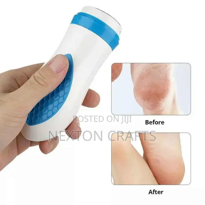 Foot Care Pedi Spin Electric Calluses Massager