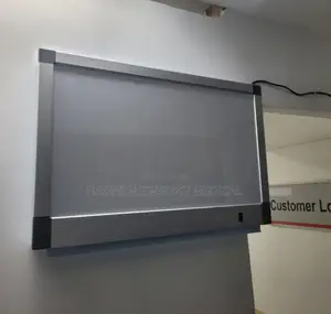 X-Ray Viewer( Double)/Xray Viewer