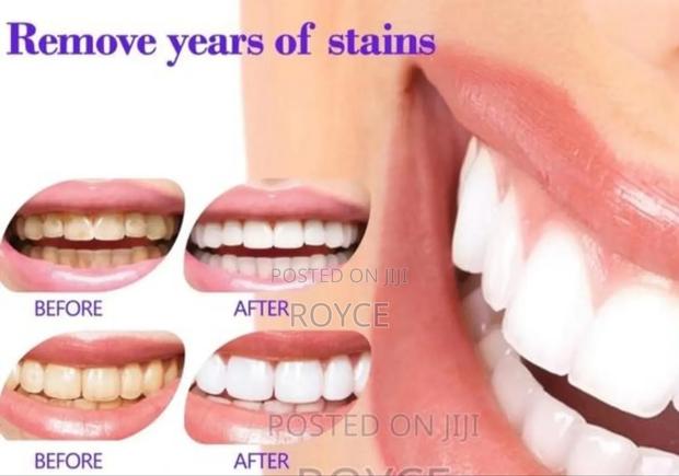 Lanthome Teeth Whitening Mouse - thumbnail 5