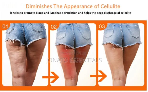 Wooden Lymphatic Drainage and Cellulite Remover Massager - thumbnail 3