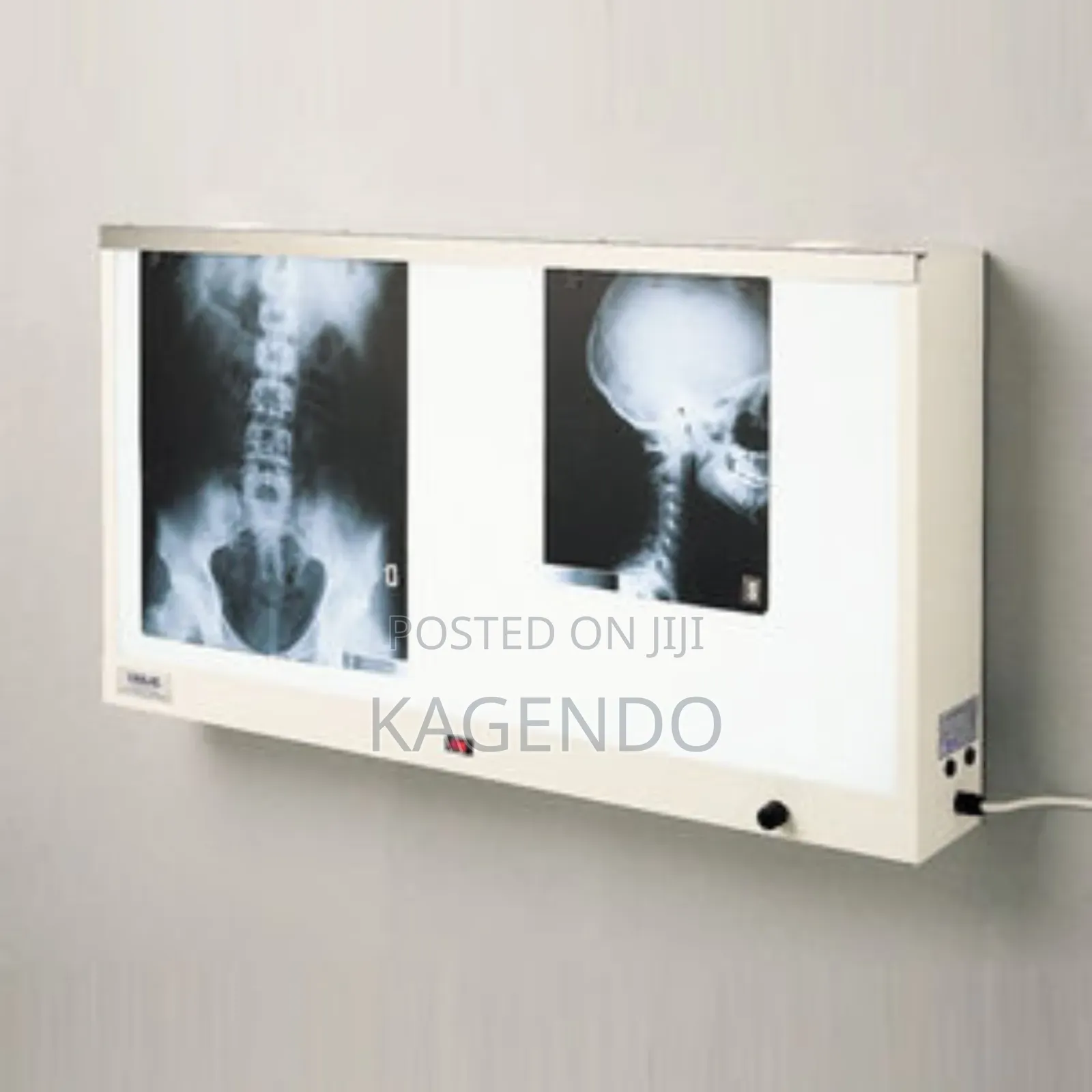 Xray Viewer