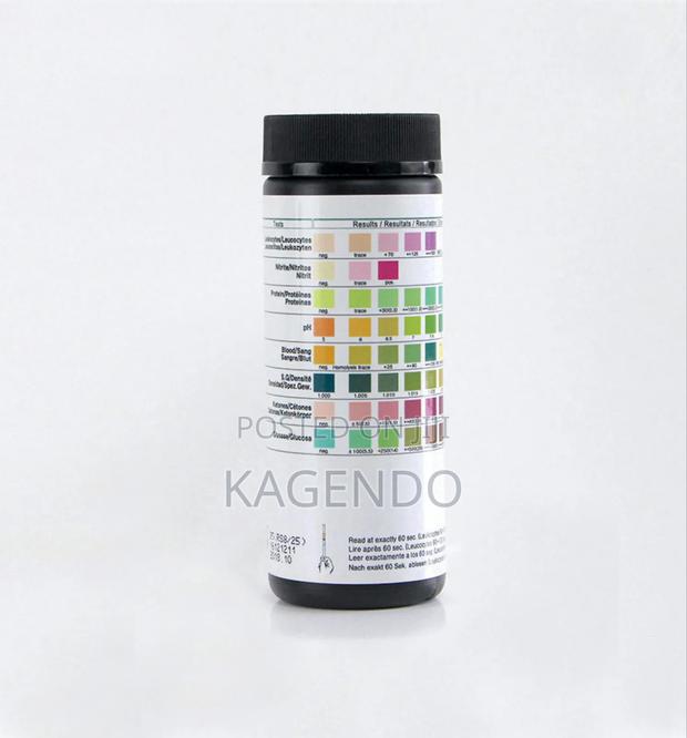 Urinalysis Strips