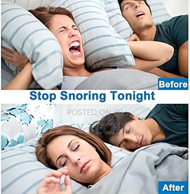 Spiral 4 Pcs Anti-snore Apparatus - thumbnail 5