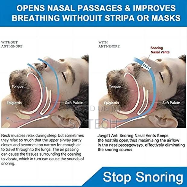 Spiral 4 Pcs Anti-snore Apparatus - thumbnail 6