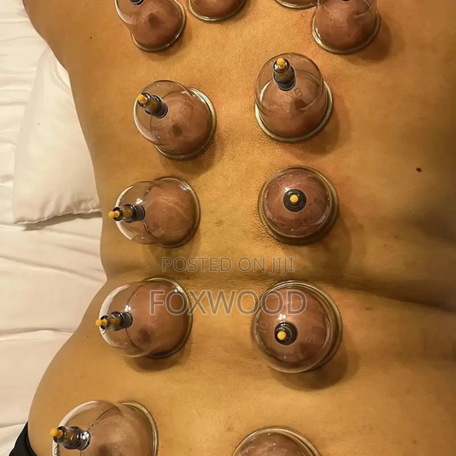 18pcs Suction Vacuum Cupping Set With 1 Manual Pump,