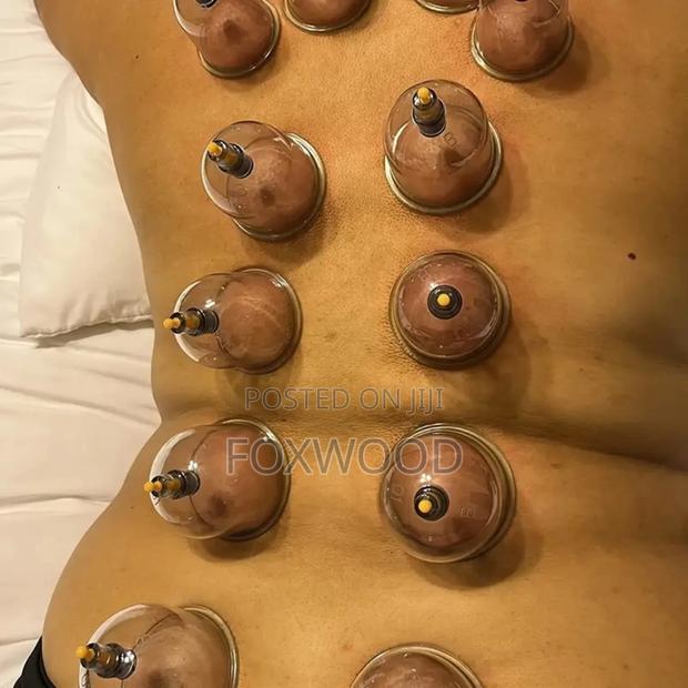 18pcs Suction Vacuum Cupping Set With 1 Manual Pump, - thumbnail 5