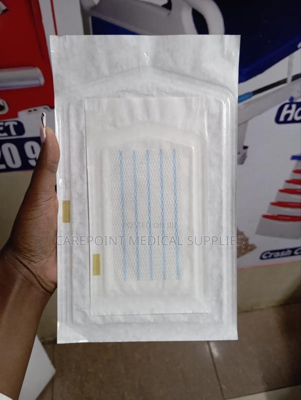 Hernia Mesh