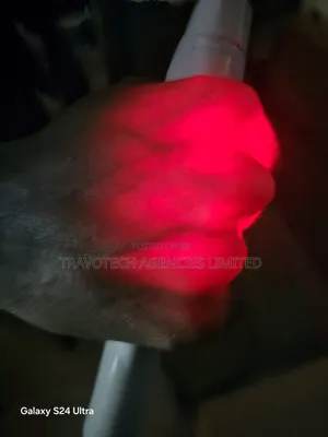 Vein Finders