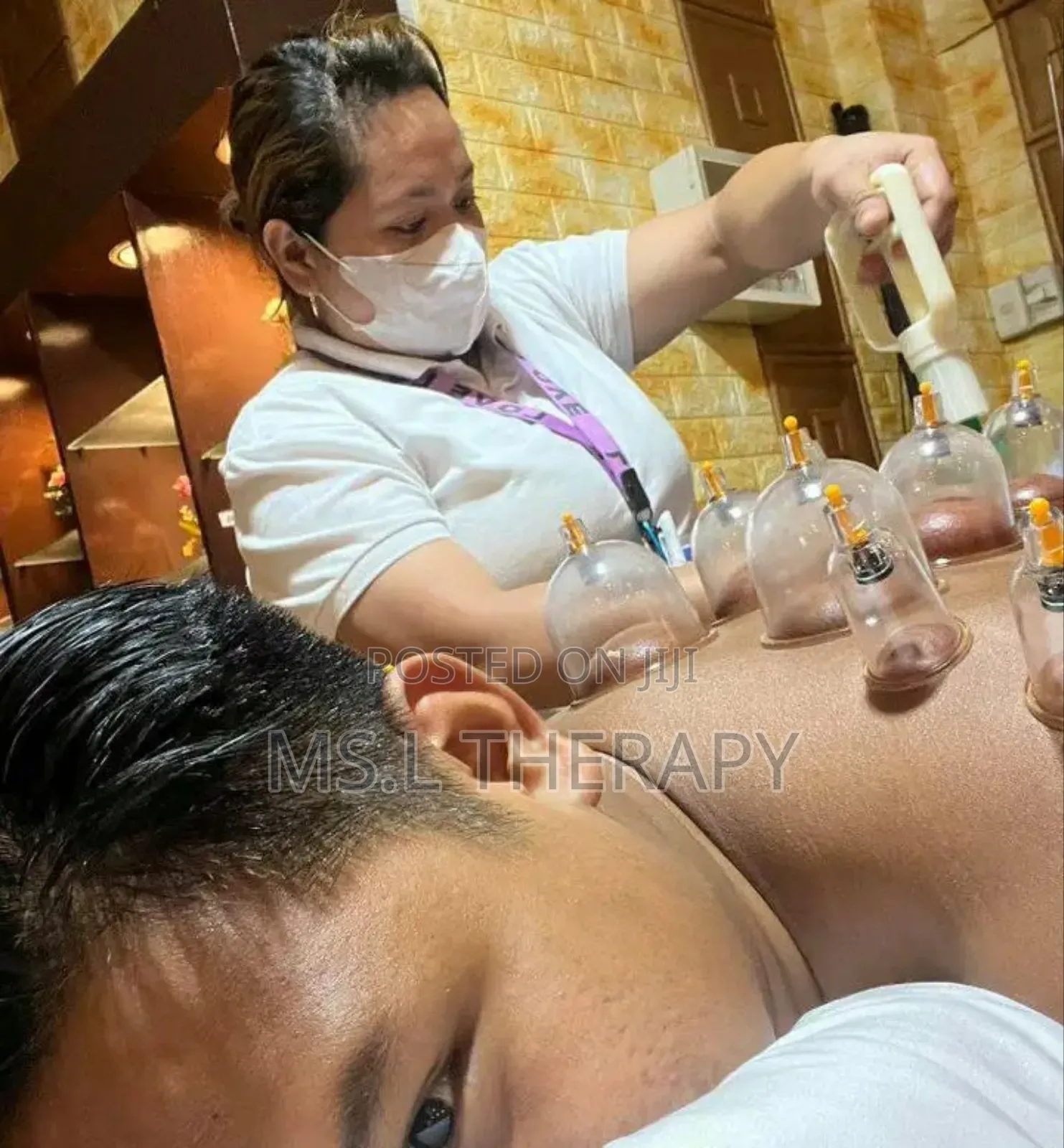 Vacuum Cupping And Hijama Treatment