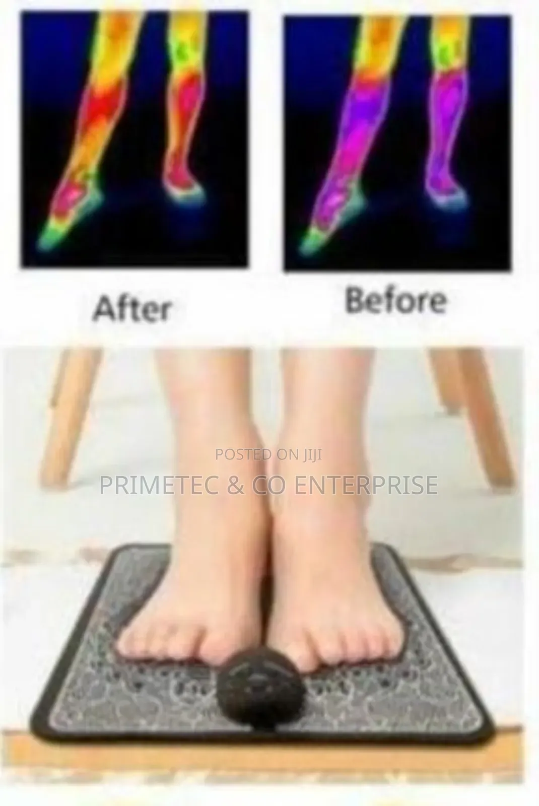 Electric Foot Acupoint Massager