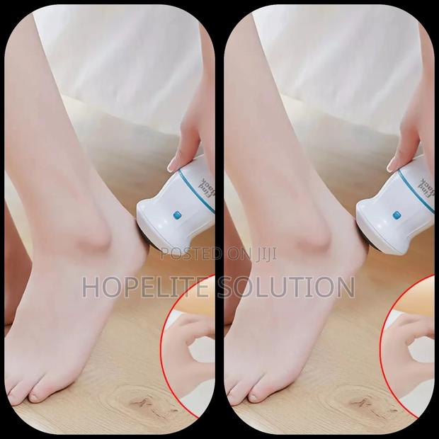 Foot File , Callous Remover - main view