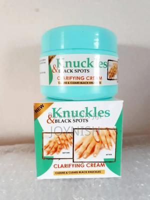 Knuckles Blackspot Clarifying Cream - thumbnail 2