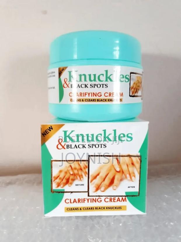 Knuckles Blackspot Clarifying Cream - main view