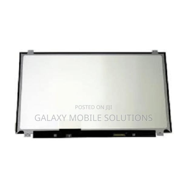 15.6 40 Pin Laptop Screen - main view