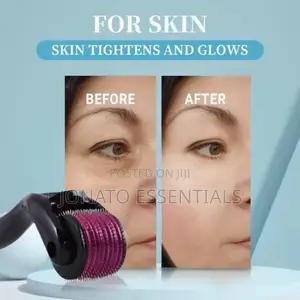 Derma Roller Microneedling Kit for Acne Scars Anti-Aging