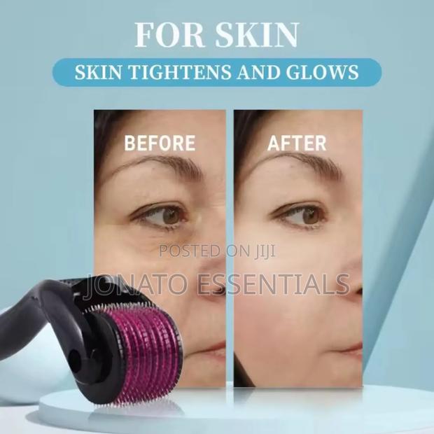 Derma Roller Microneedling Kit for Acne Scars Anti-Aging - thumbnail 2