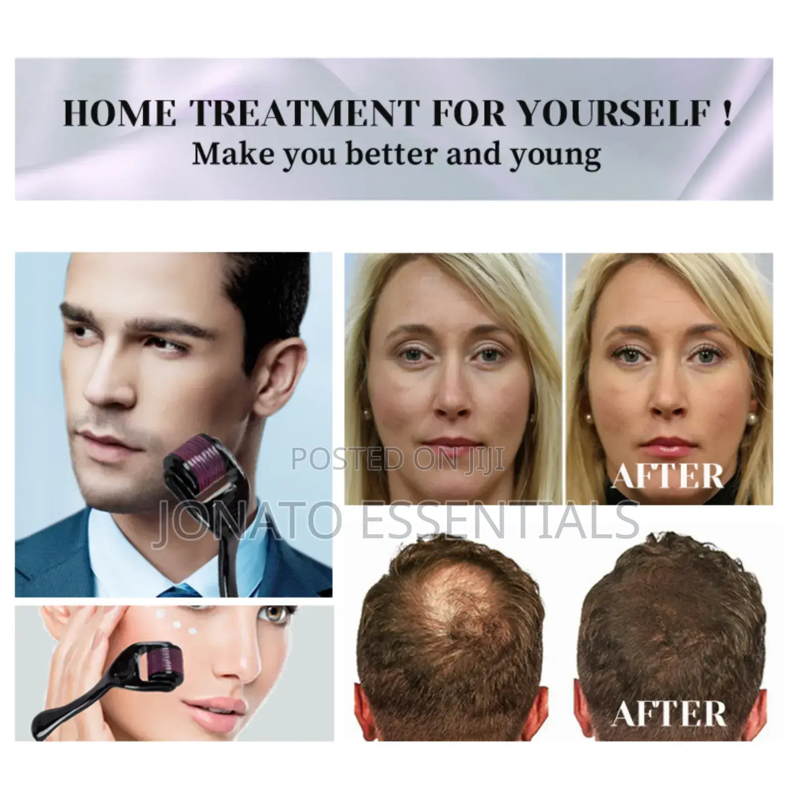 Derma Roller for Hair Growth, Beard Skin Care, Microneedle