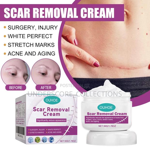 Quality Scar Removal Cream - main view