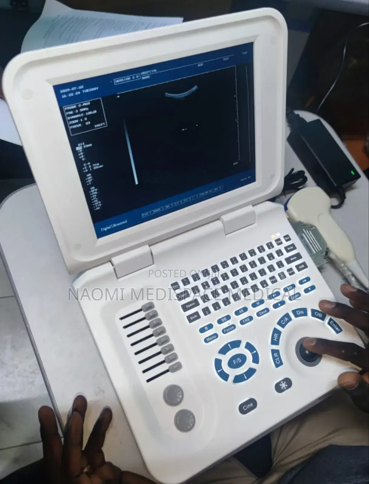 Ecomed Black and White Ultrasound With Printer