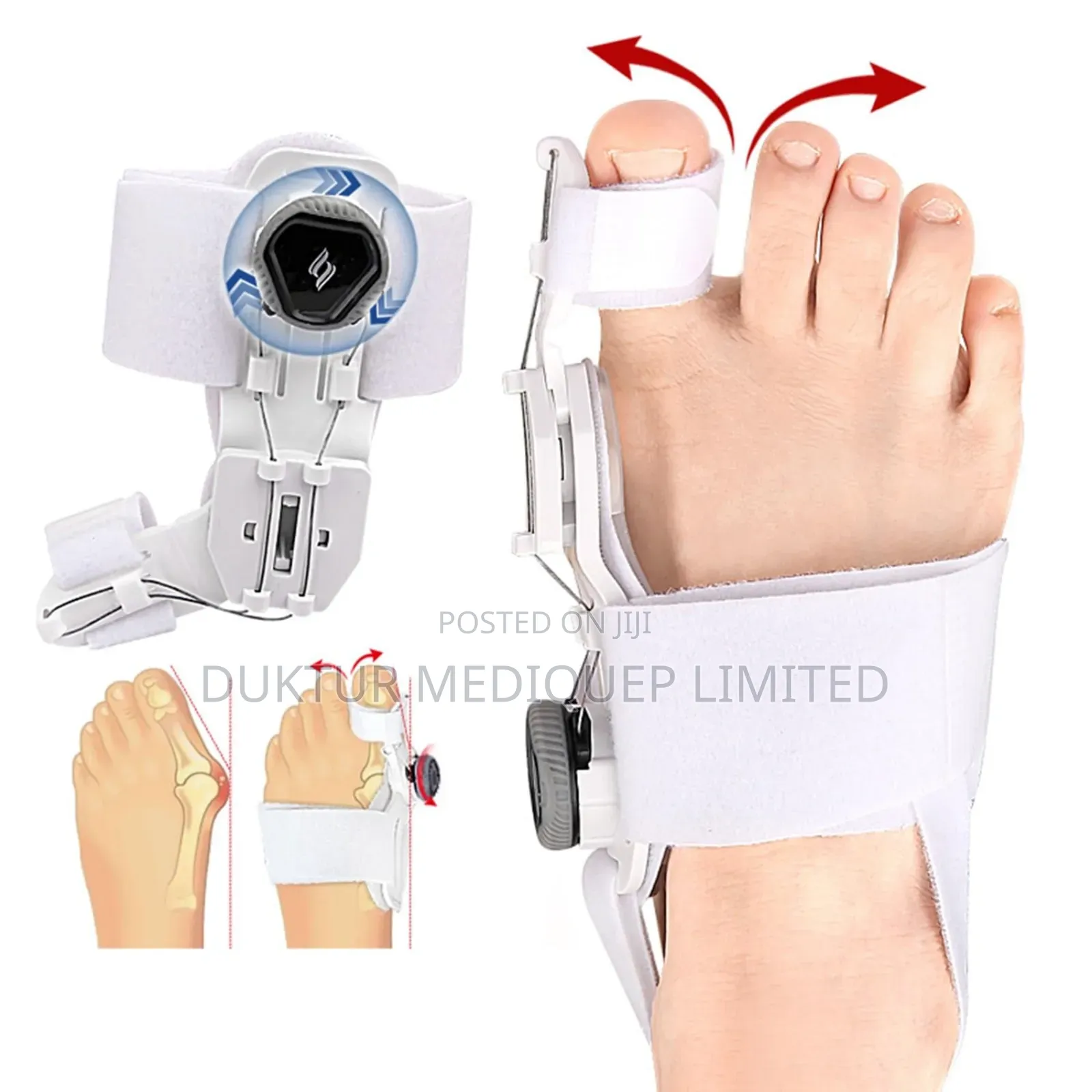 Adjustable Hallux Valgus Splint, Bunion Splint