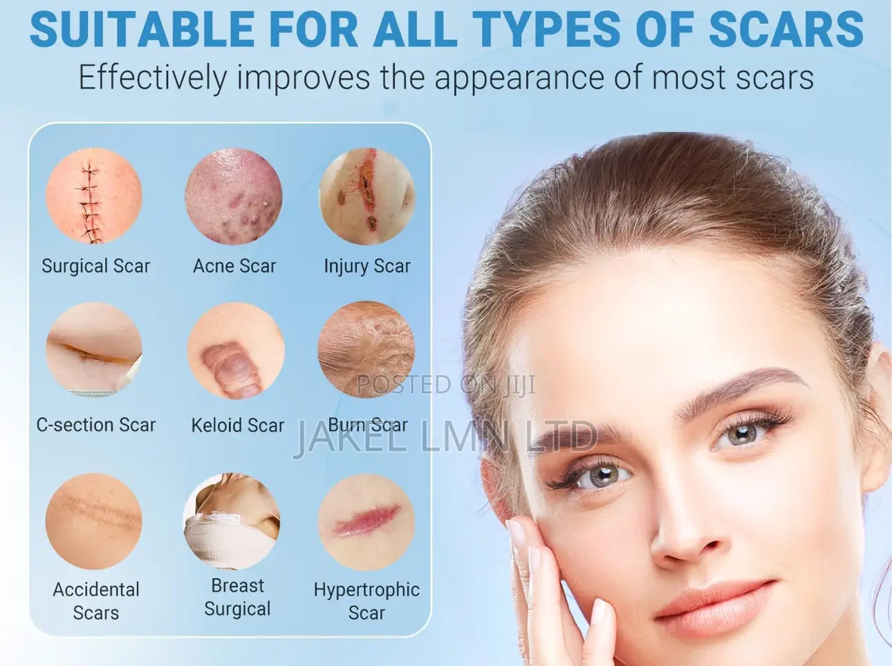 Kelo Cote Silicone Scar Gel Treatment- 15g