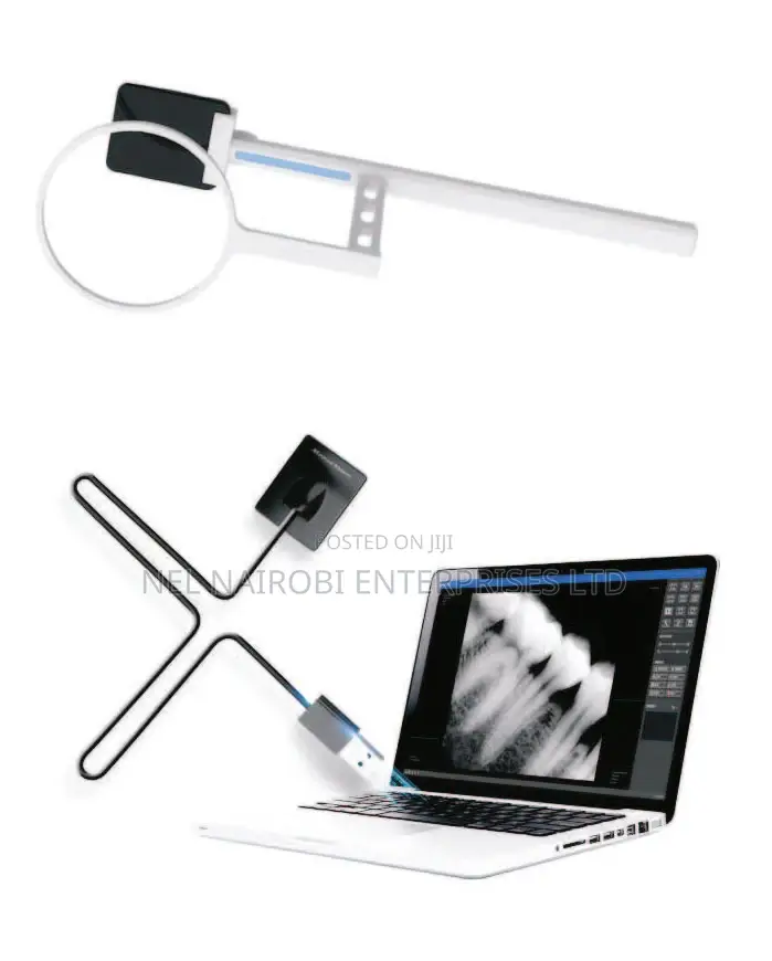 Digital Intraoral X-Ray Sensor (S2530) Size: 1.5