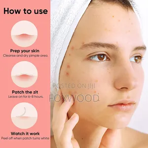 Acne Pimple Patch (36 Patches)