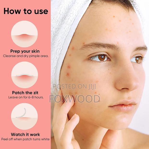 Acne Pimple Patch (36 Patches) - thumbnail 2