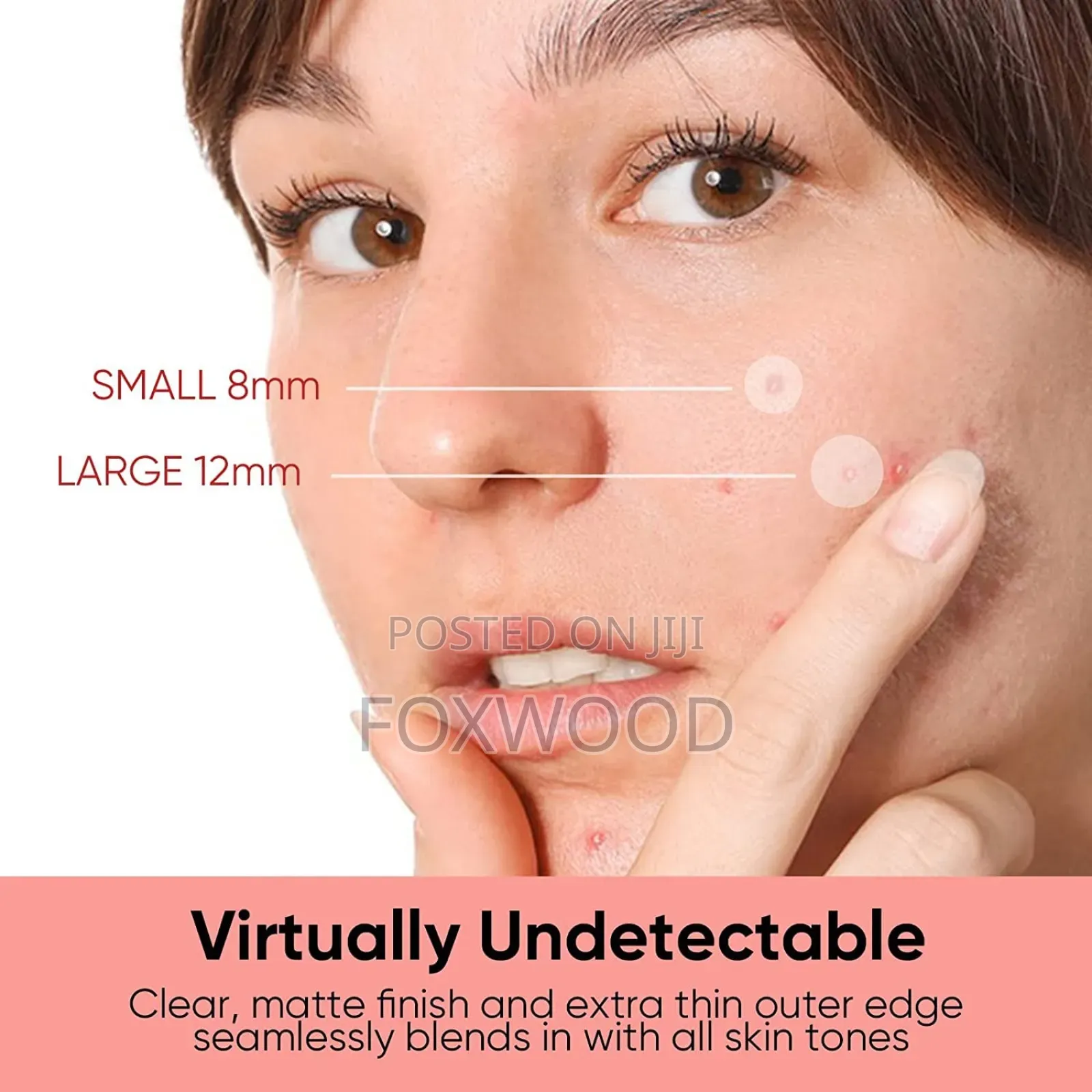 Acne Pimple Patch (36 Patches)