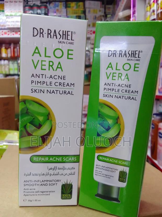 Aloe Vera Anti Acne Pimple Cream