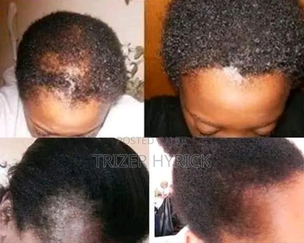 Arandi Cold Pressed Oil - thumbnail 3