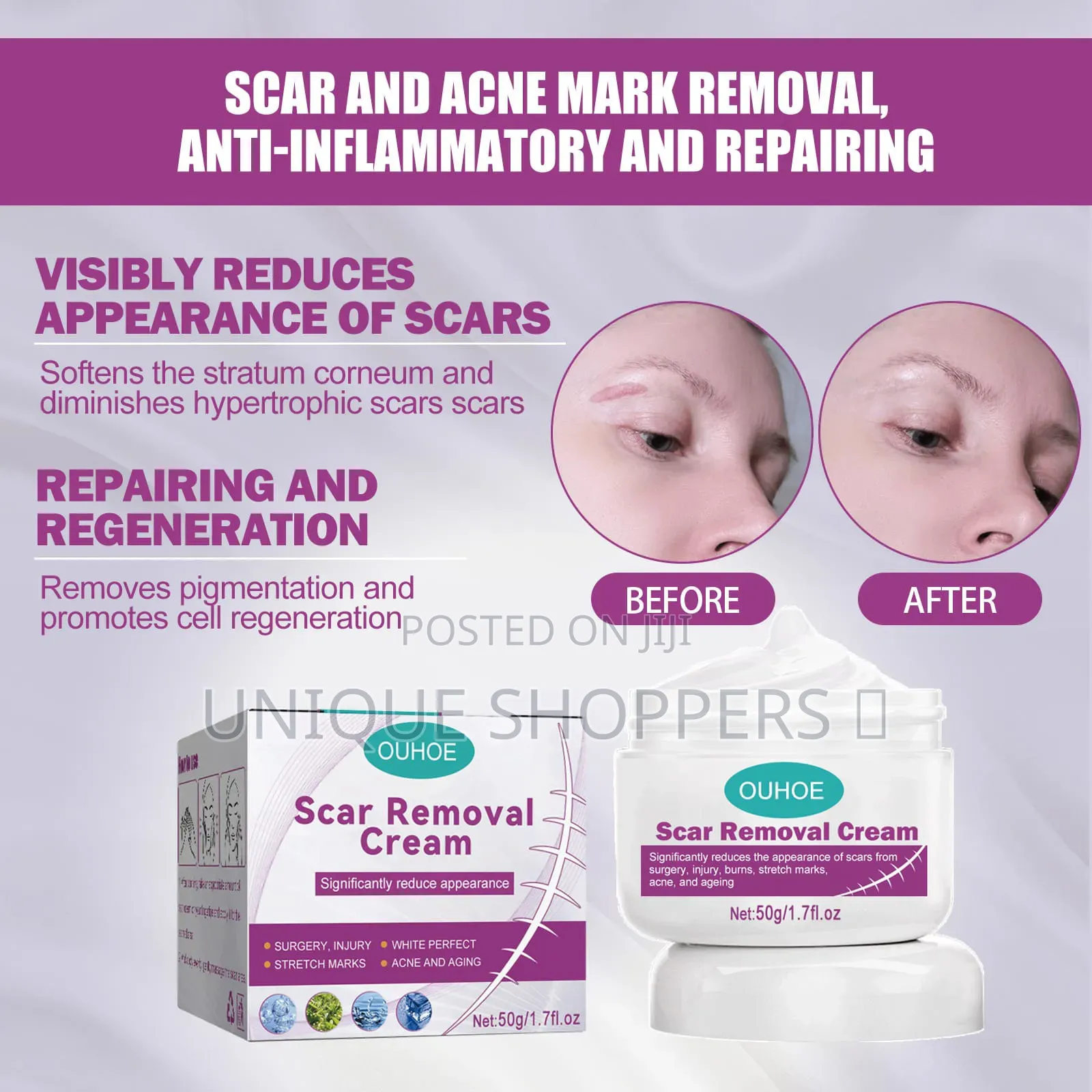 Scar And Acne Remover